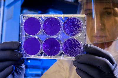 Wissenschaftlerin beobachtet keime in Petrischalen