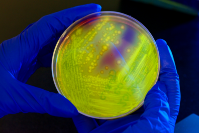Hands wearing protective gloves carry a petri dish with a yellow liquid